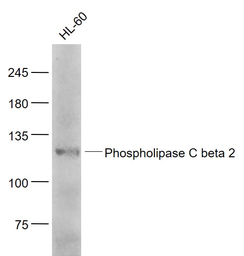 Phospholipase C beta 2 Rabbit 