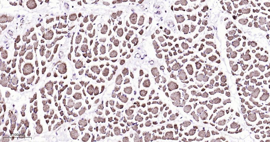 VDAC1 Recombinant Rabbit mAb, 