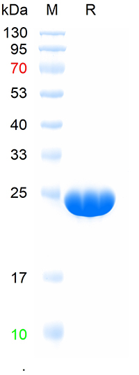 Human CRP protein(bs-41211P)-1