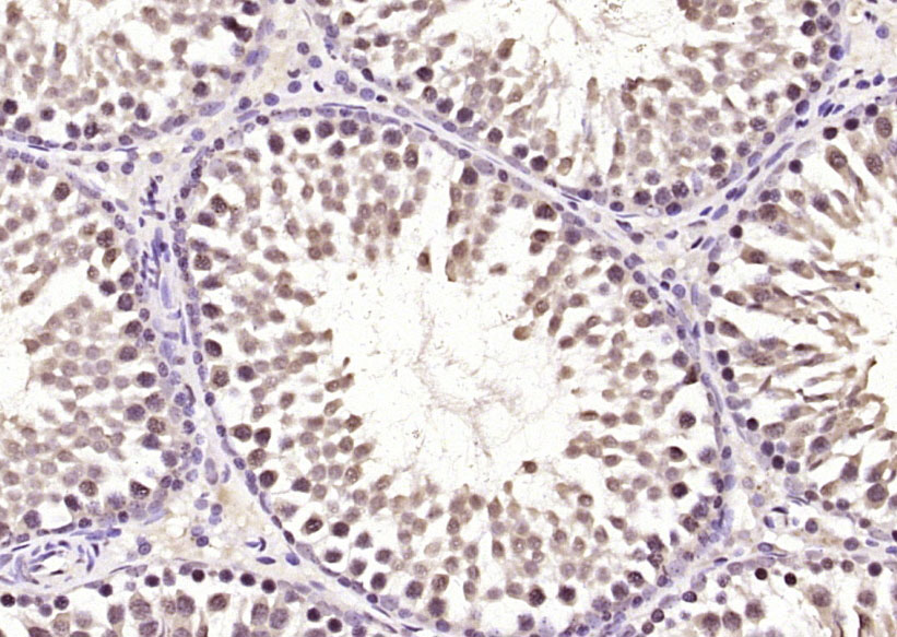 DYRK2 Rabbit pAb(bs-12332R)-50