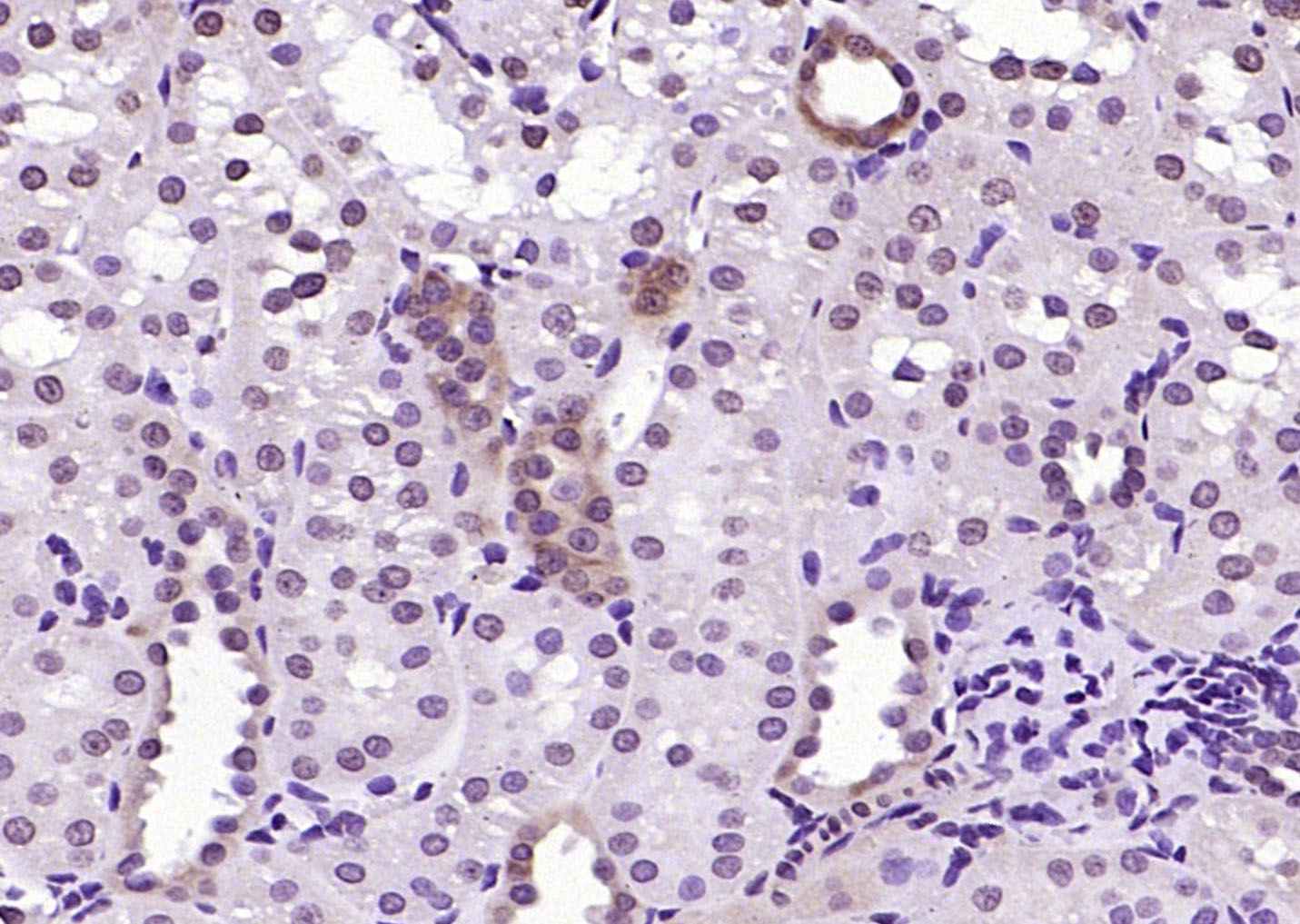 RGC32/C13orf15 Rabbit pAb(bs-9