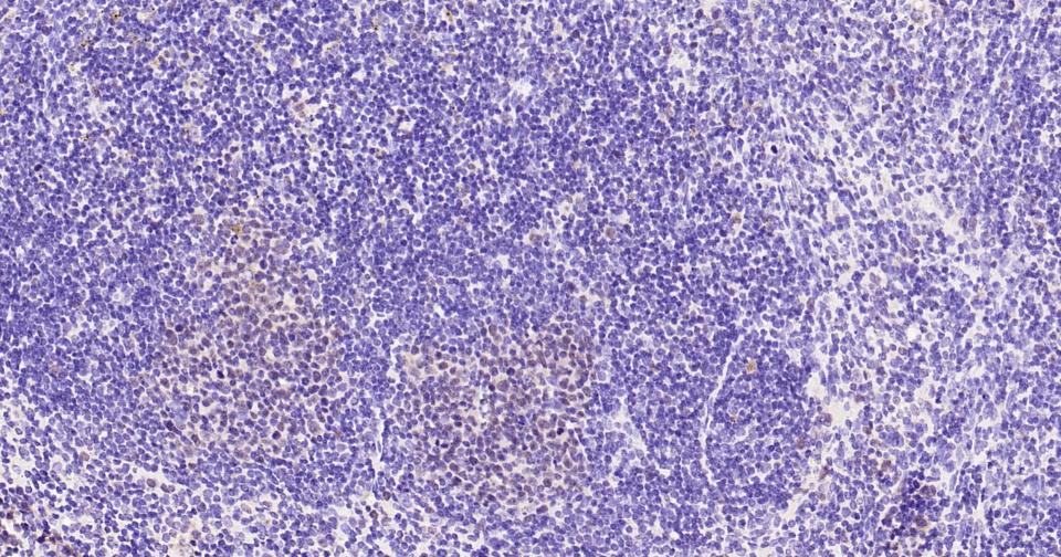 PCNA Rabbit pAb(bs-10889R)-50u