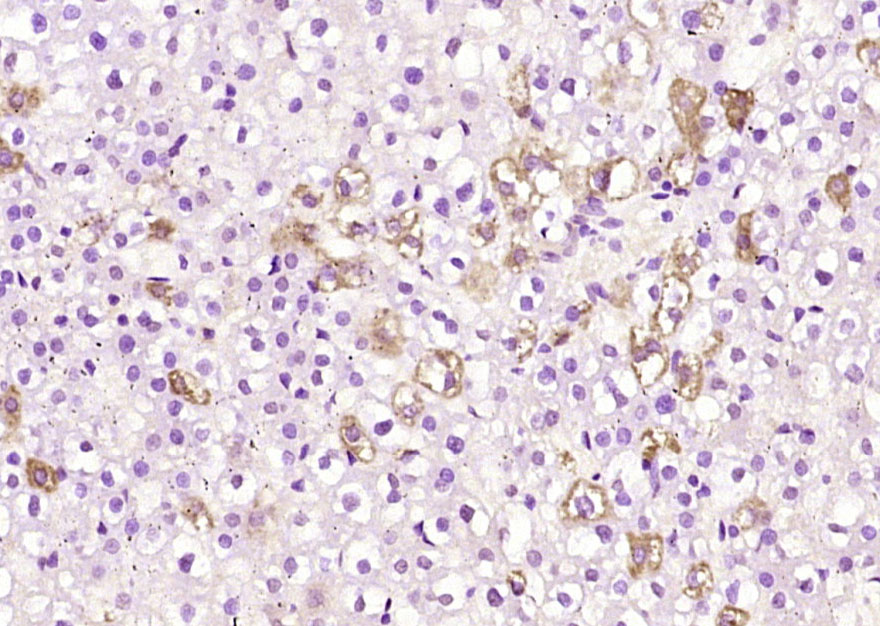 PARP4 Rabbit pAb(bs-7109R)-50u