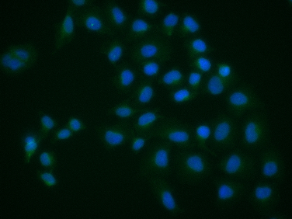 CDK11 Rabbit pAb(bs-3999R)-50u