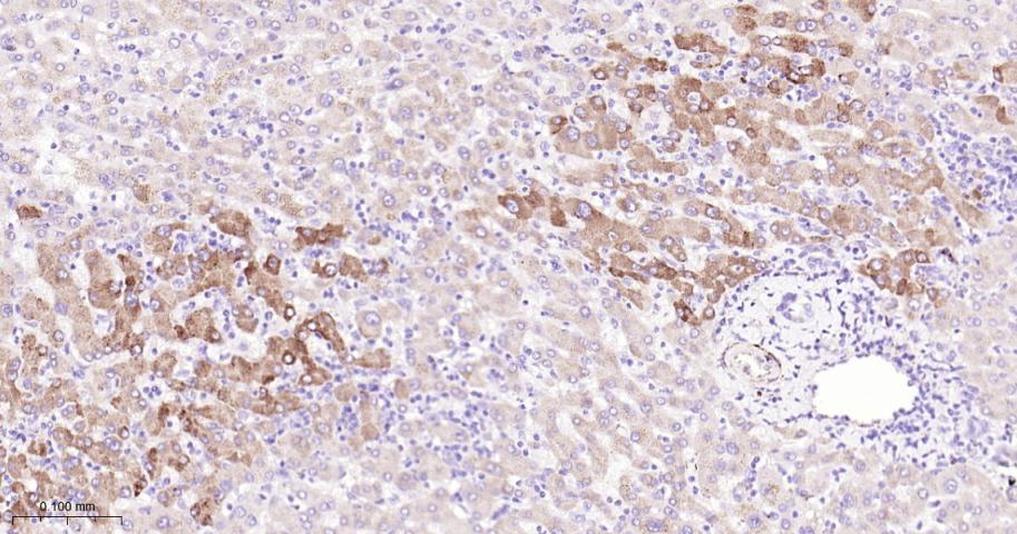 IL13RA1 Recombinant Rabbit mAb
