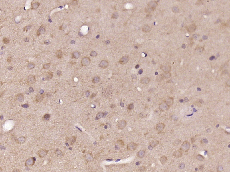 DNASE1L2 Rabbit pAb(bs-14395R)