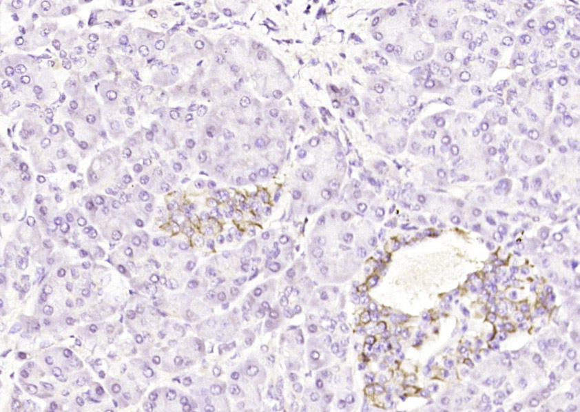 GBP5 Rabbit pAb(bs-7019R)-50ul