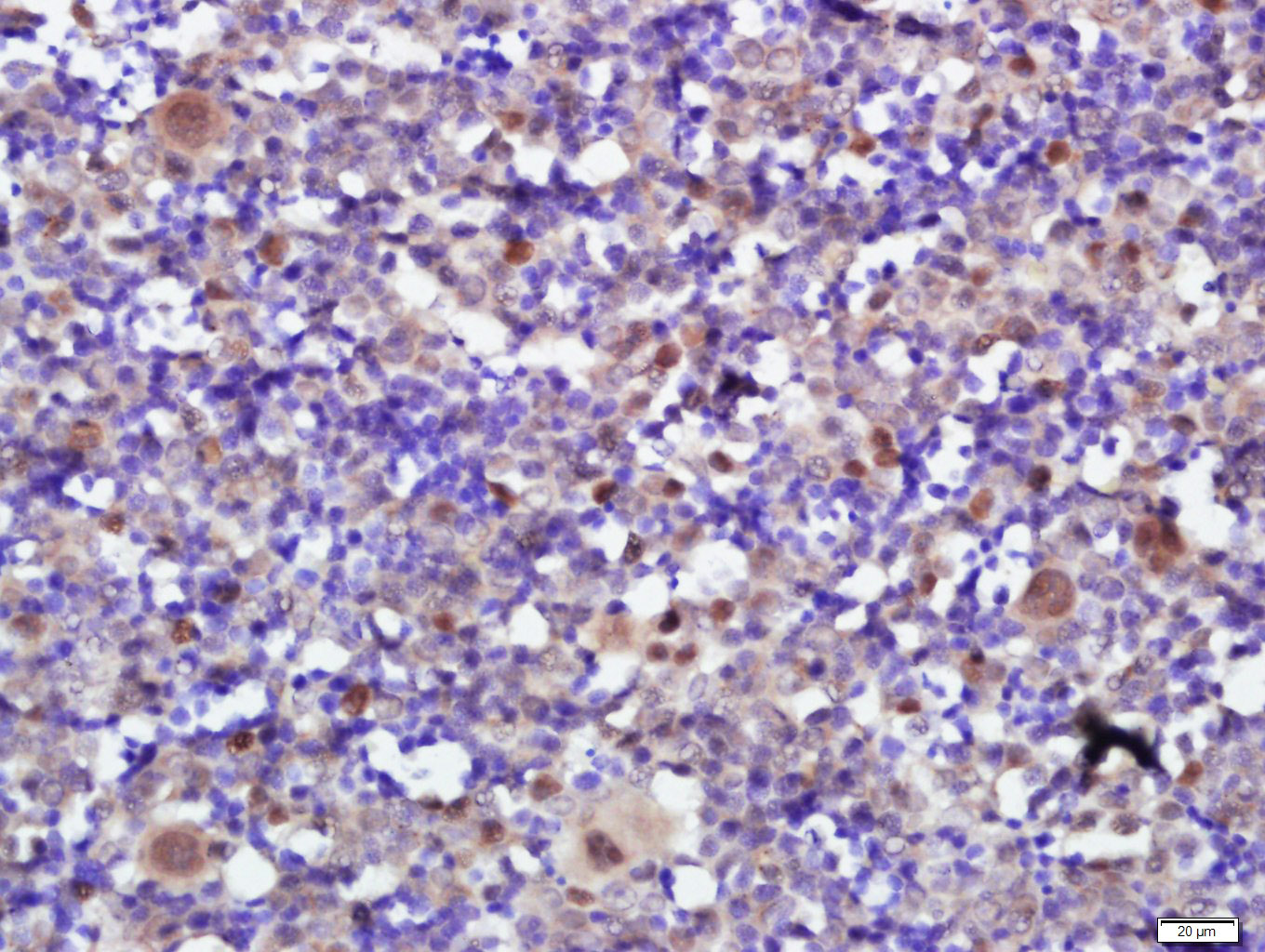 PLAG1 Rabbit pAb(bs-10092R)-50