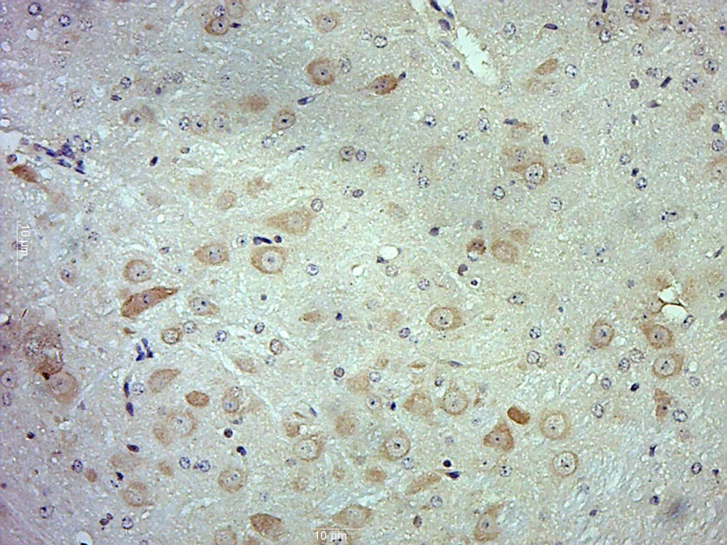 GSTA1 Rabbit pAb(bs-13398R)-50