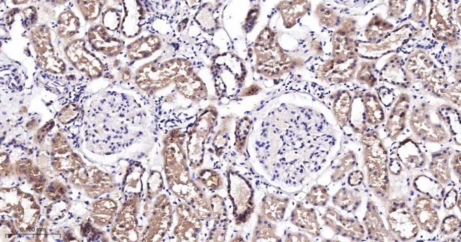 EEF1A1 Recombinant Rabbit mAb(