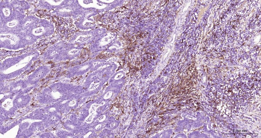 CD163 Rabbit pAb(bs-2527R)-50u