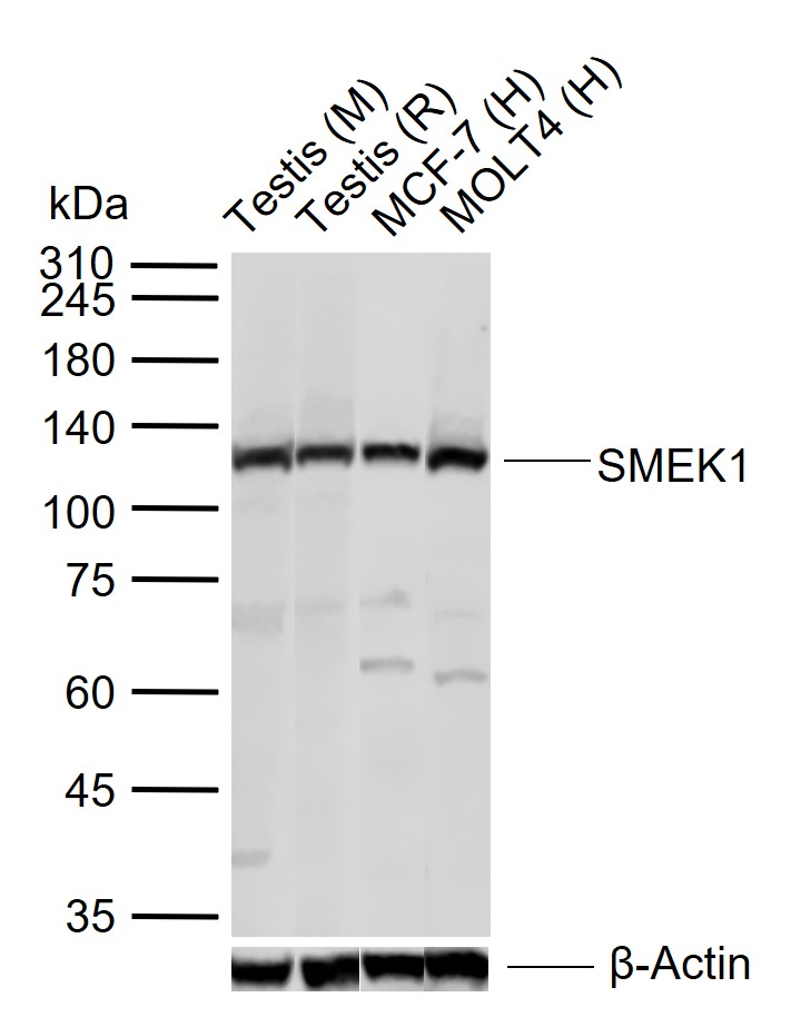 SMEK1 Rabbit pAb(bs-12636R)-50