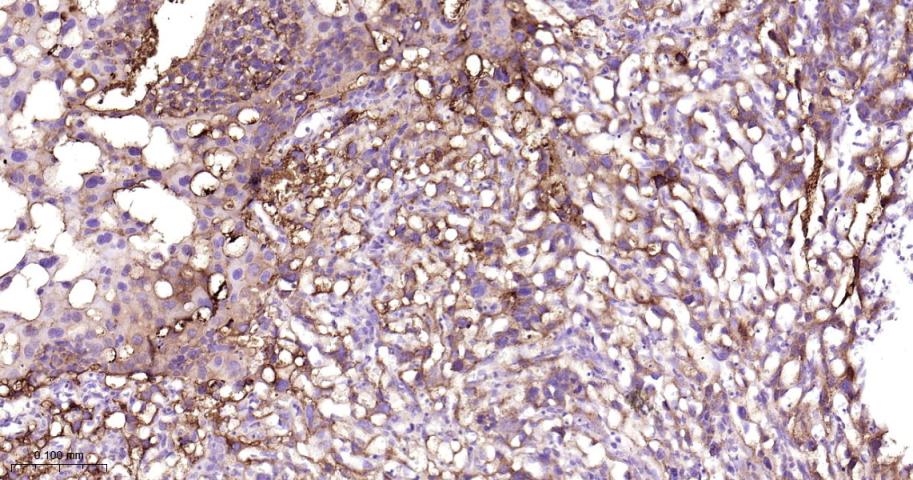 GBA Recombinant Rabbit mAb(bsm