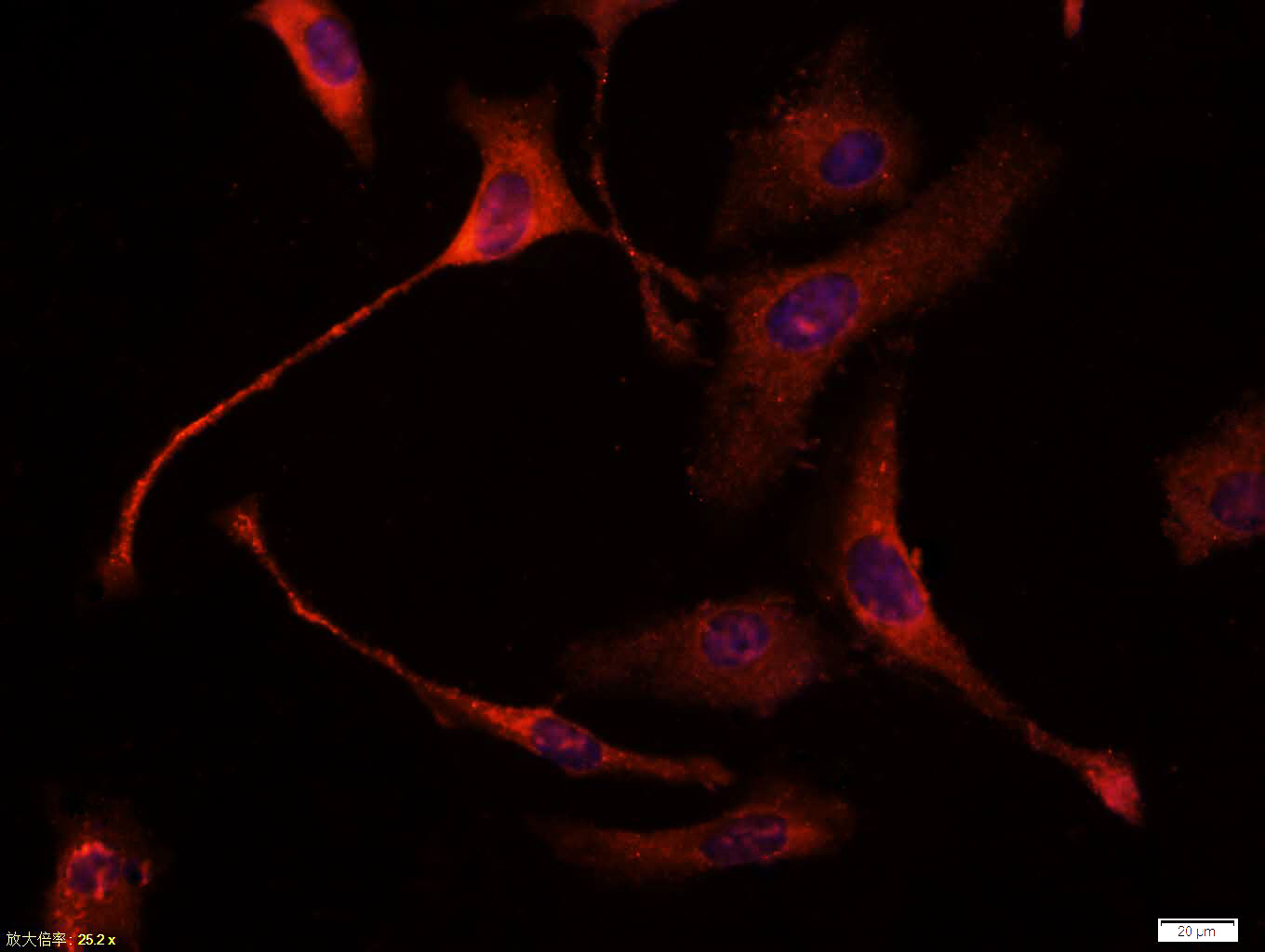 CK18 Mouse mAb(bsm-33102M)-50u