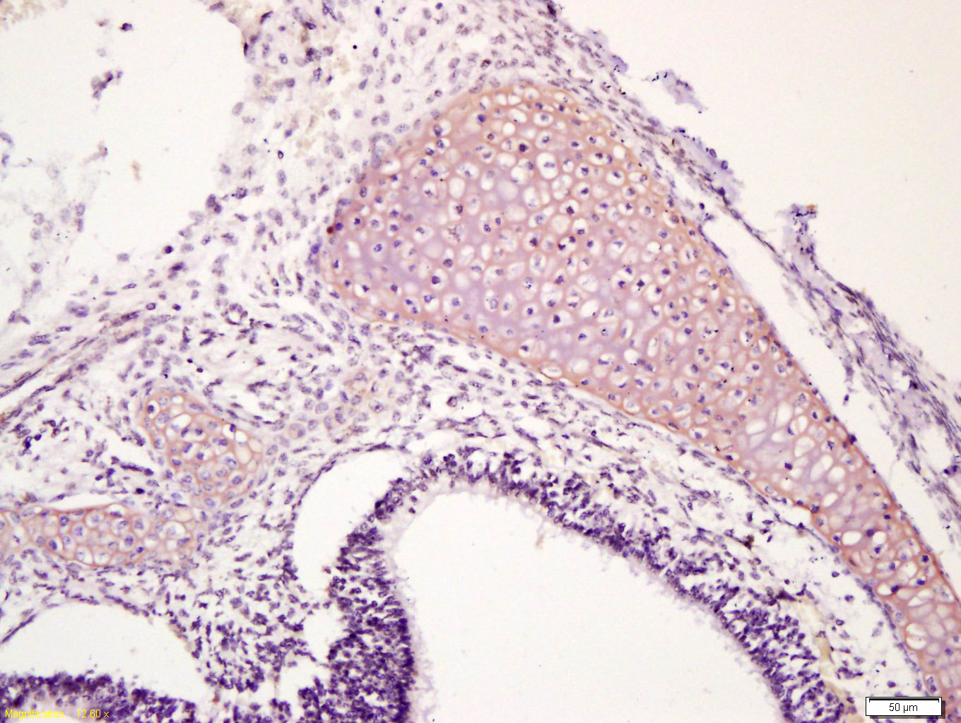 Cytokeratin 1 Rabbit pAb(bs-12