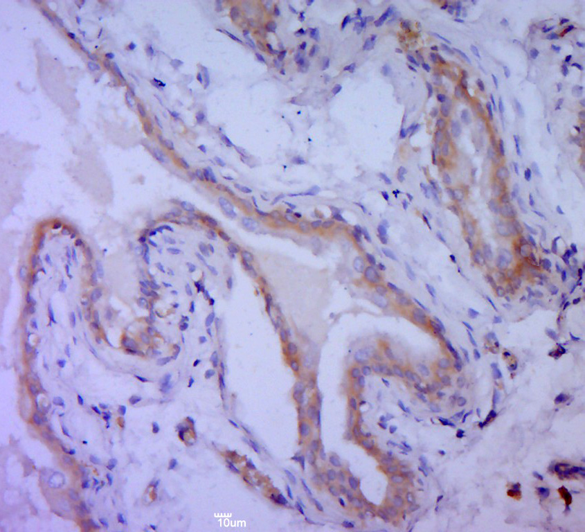 Bcl-2 Rabbit pAb(bs-20352R)-50