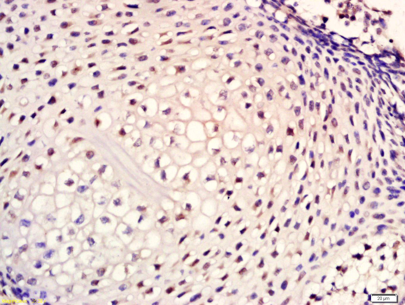 Cytokeratin 1 Rabbit pAb(bs-12