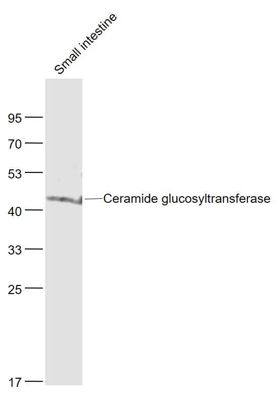 Ceramide glucosyltransferase R