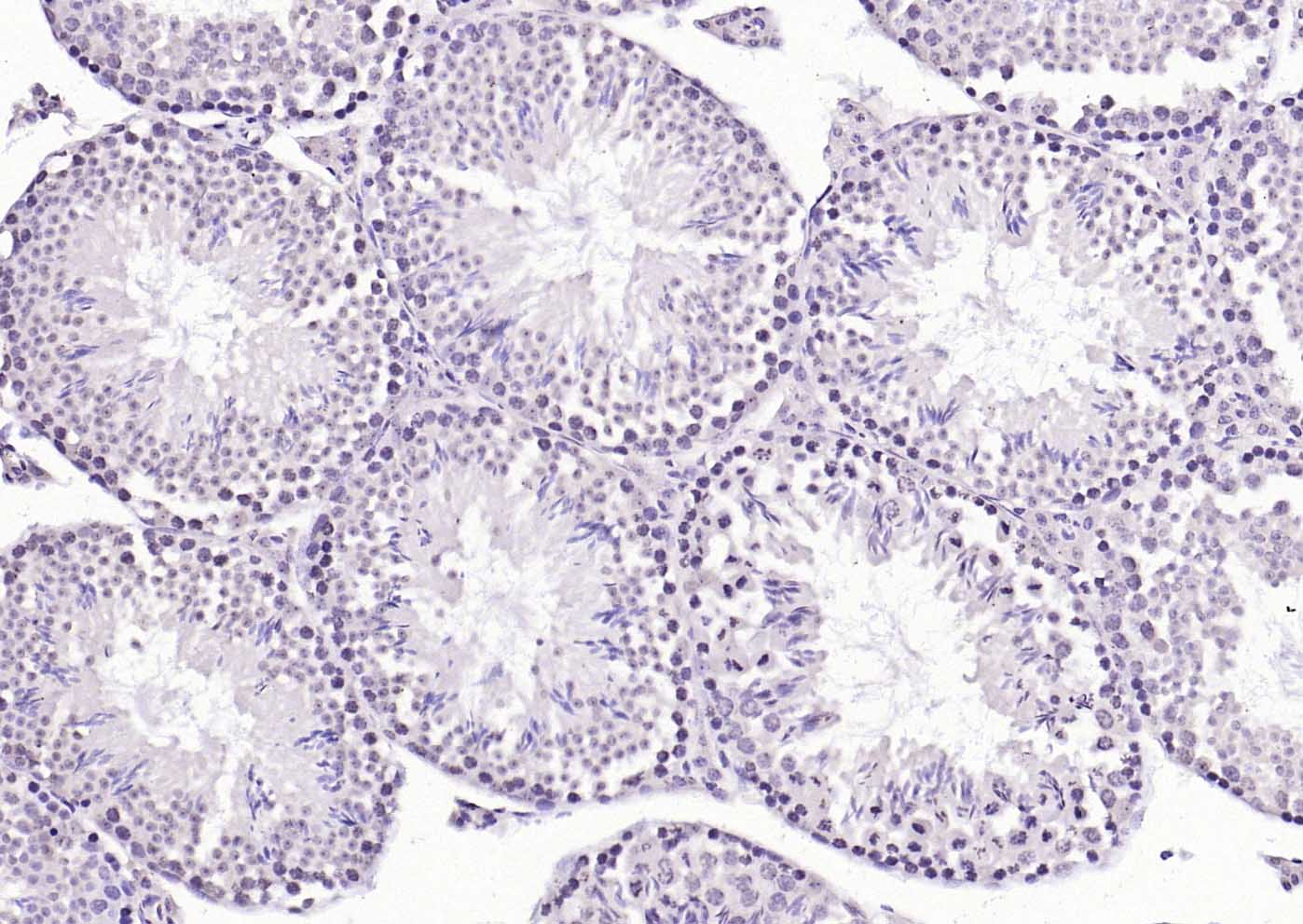 HSF1 Rabbit pAb(bs-3757R)-50ul