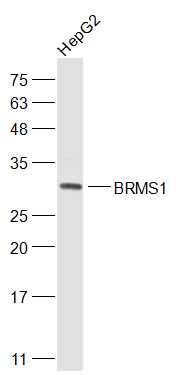 BRMS1 Rabbit pAb(bs-8686R)-50u