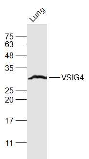 VSIG4 Rabbit pAb(bs-0479R)-50u