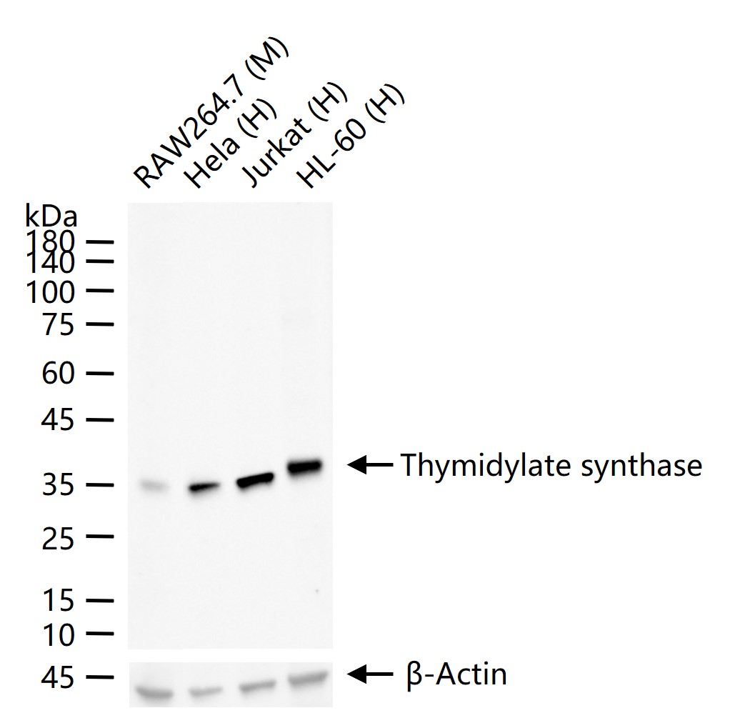 TYMS Recombinant Rabbit mAb(bs