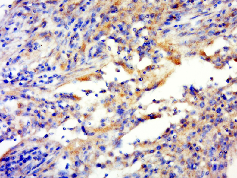 C1orf158 Rabbit pAb(bs-13757R)