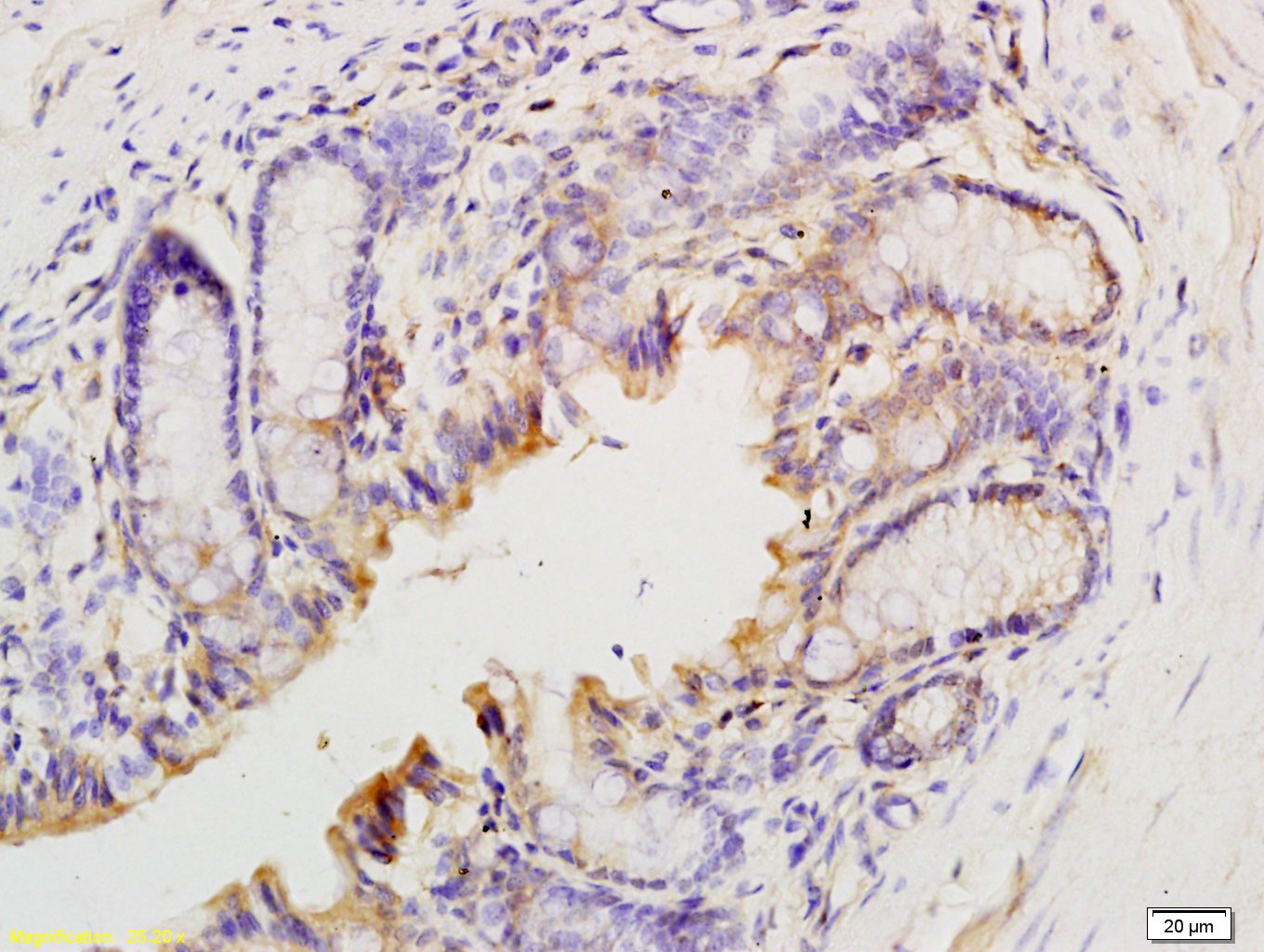 T Beta 10 Rabbit pAb(bs-1088R)