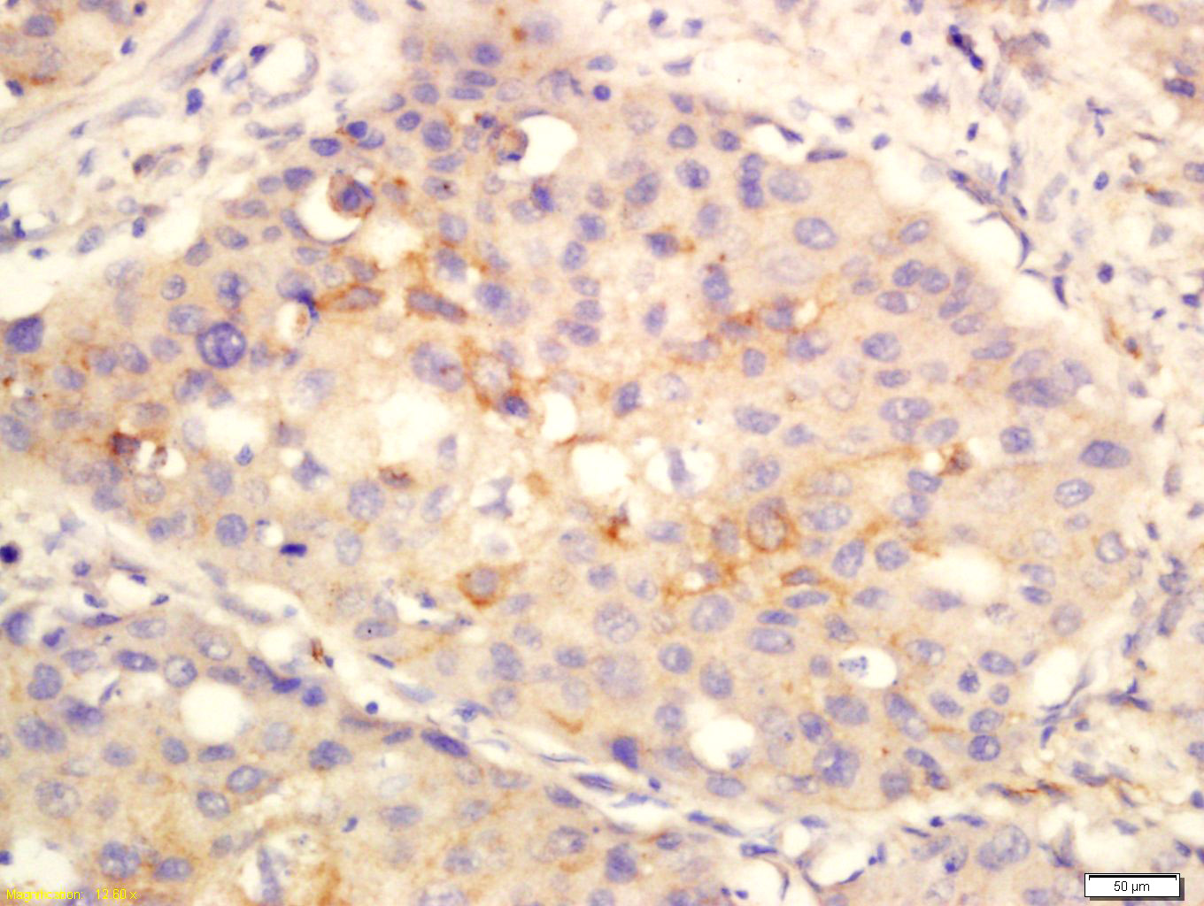 ANO1/DOG1 Rabbit pAb(bs-3794R)