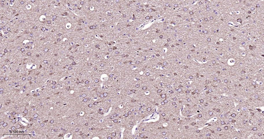 VDAC1 Recombinant Rabbit mAb, 