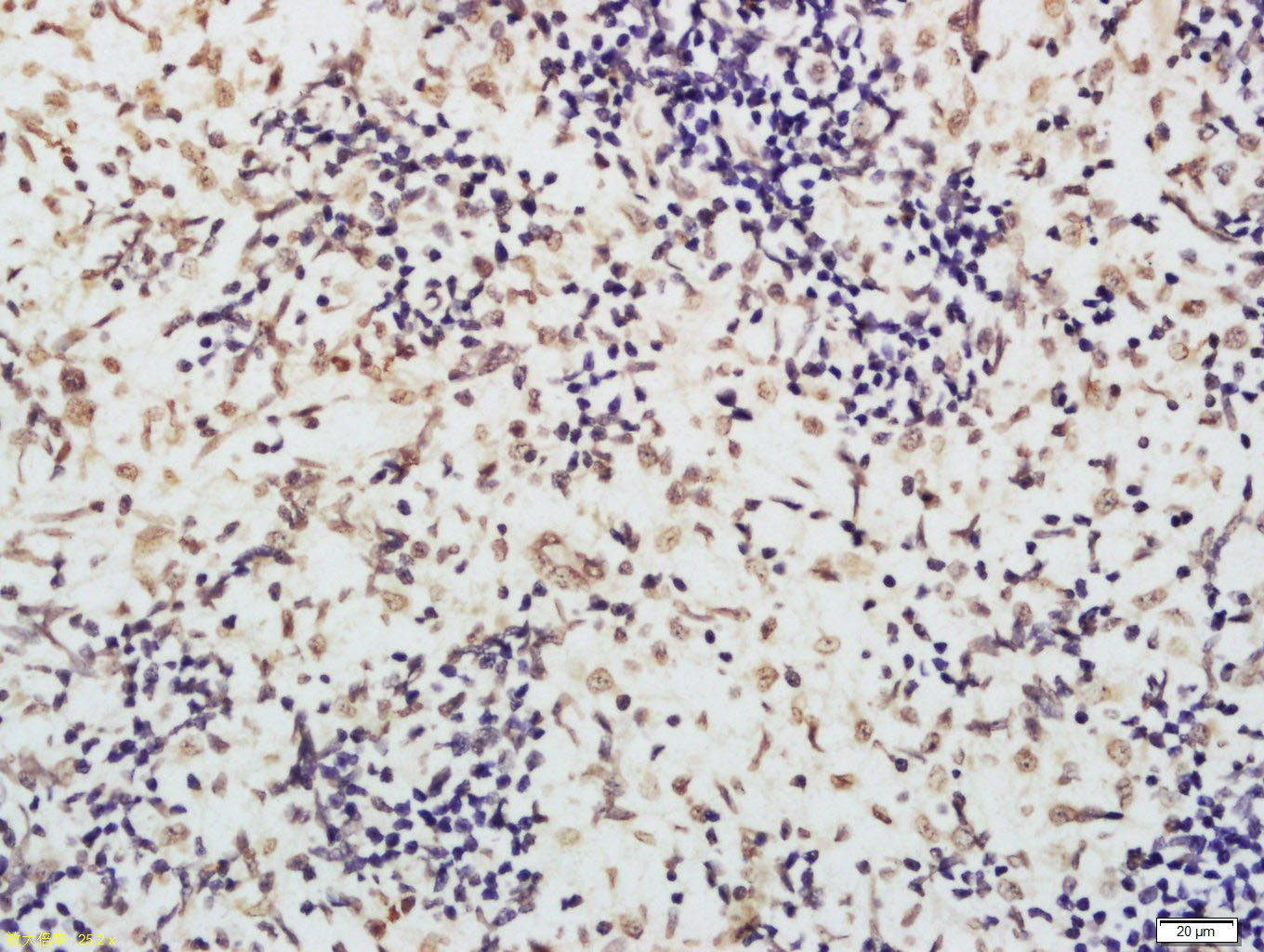 XRCC3 Rabbit pAb(bs-4261R)-50u