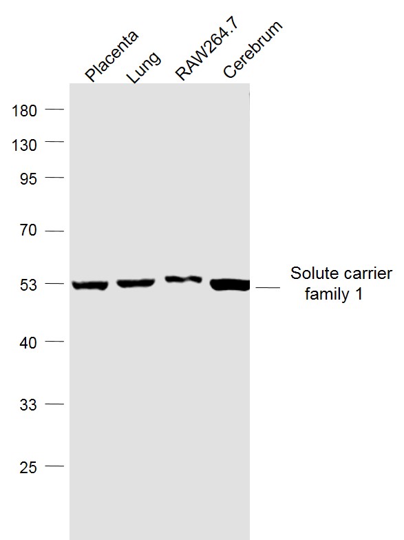 SLC1A5 Rabbit pAb(bs-21518R)-5