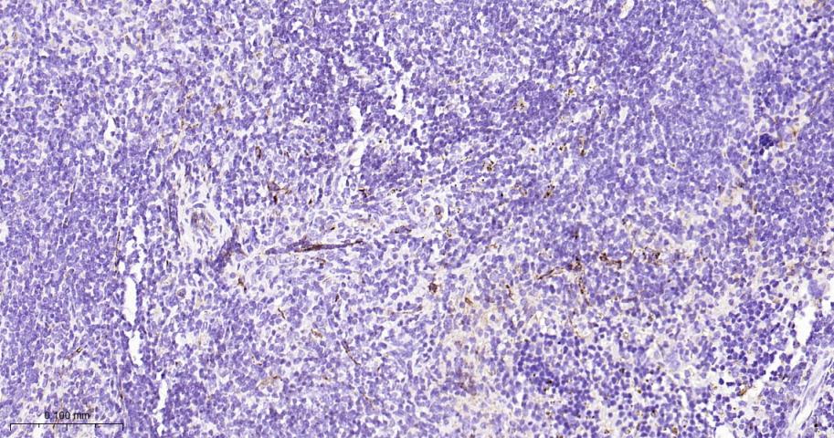 CD31 Rabbit pAb(bs-20322R)-50u