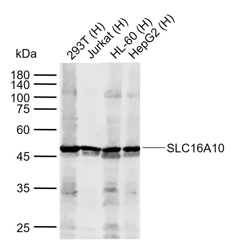 SLC16A10 Rabbit pAb(bs-19797R)