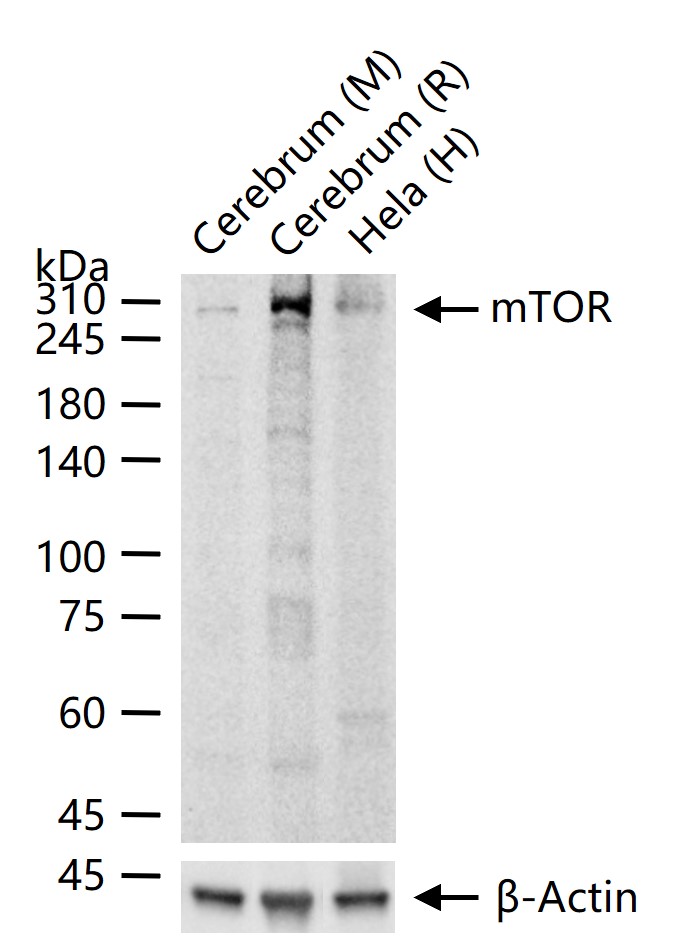mTOR Recombinant Rabbit mAb(bs