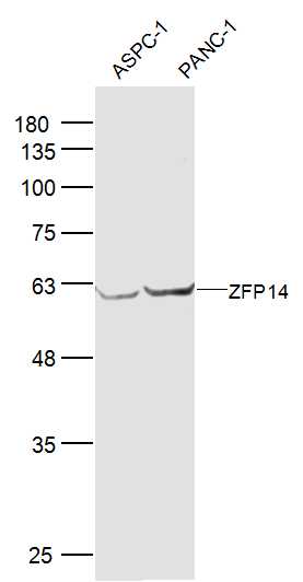 ZFP14 Rabbit pAb(bs-18526R)-50