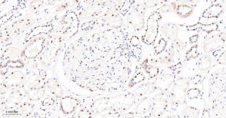mTOR Recombinant Rabbit mAb(bs