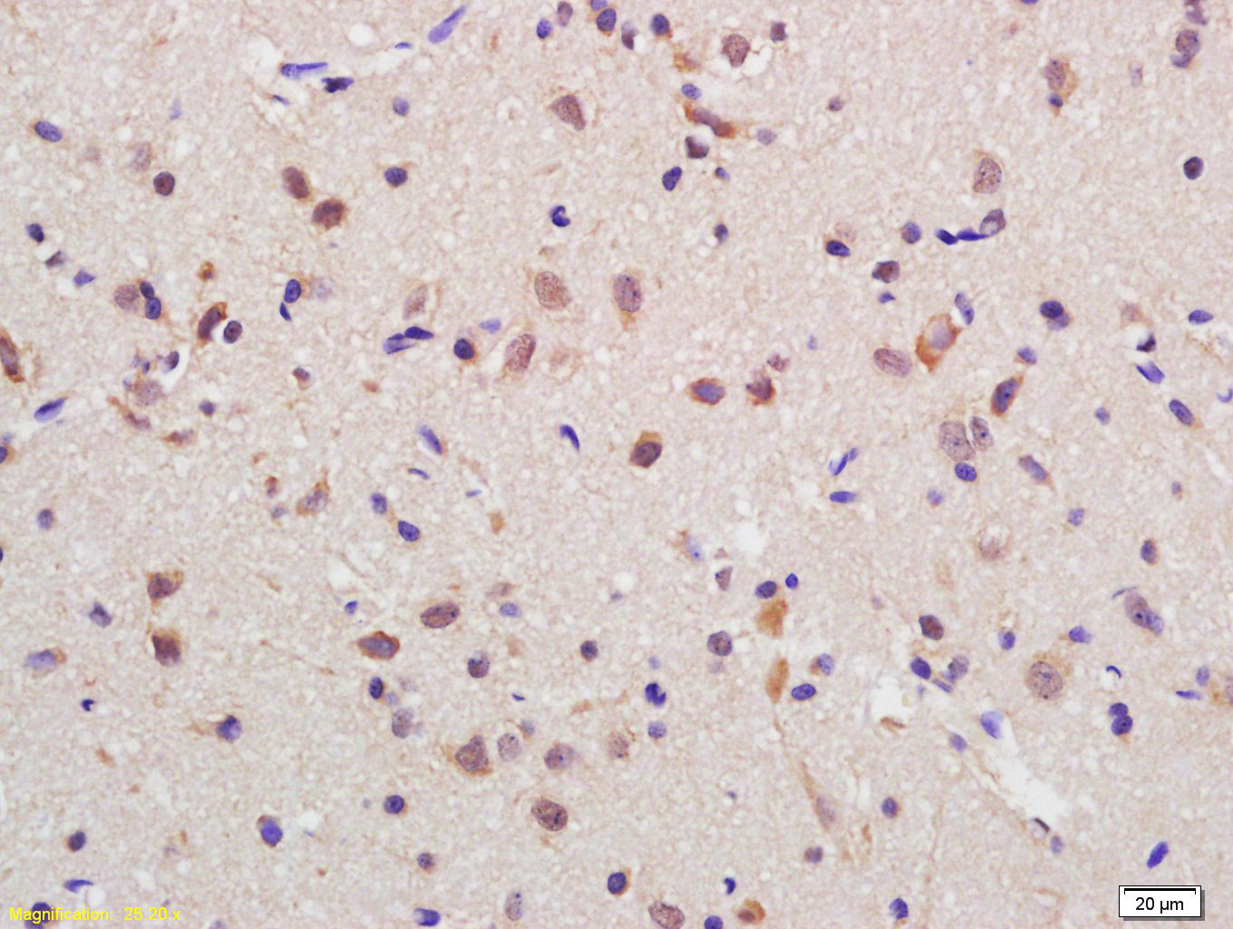 RGC32/C13orf15 Rabbit pAb(bs-9