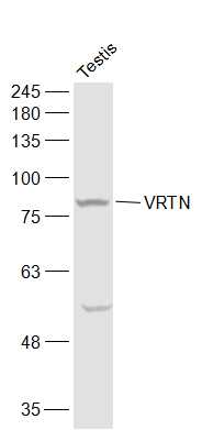 VRTN Rabbit pAb(bs-12781R)-50u