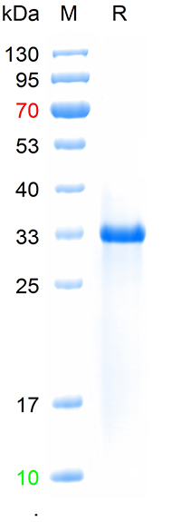 Recombinant human PSA protein,
