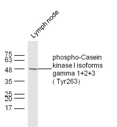 phospho-CSNK1G 1+2+3 ( Tyr263)