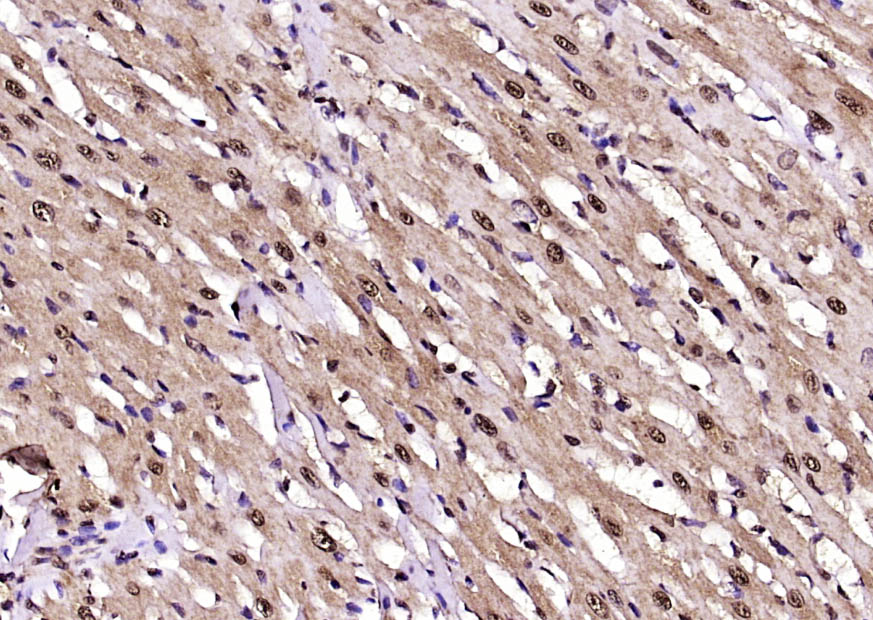 NEK6 Rabbit pAb(bs-21704R)-50u