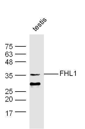 FHL1 Rabbit pAb(bs-4827R)-50ul