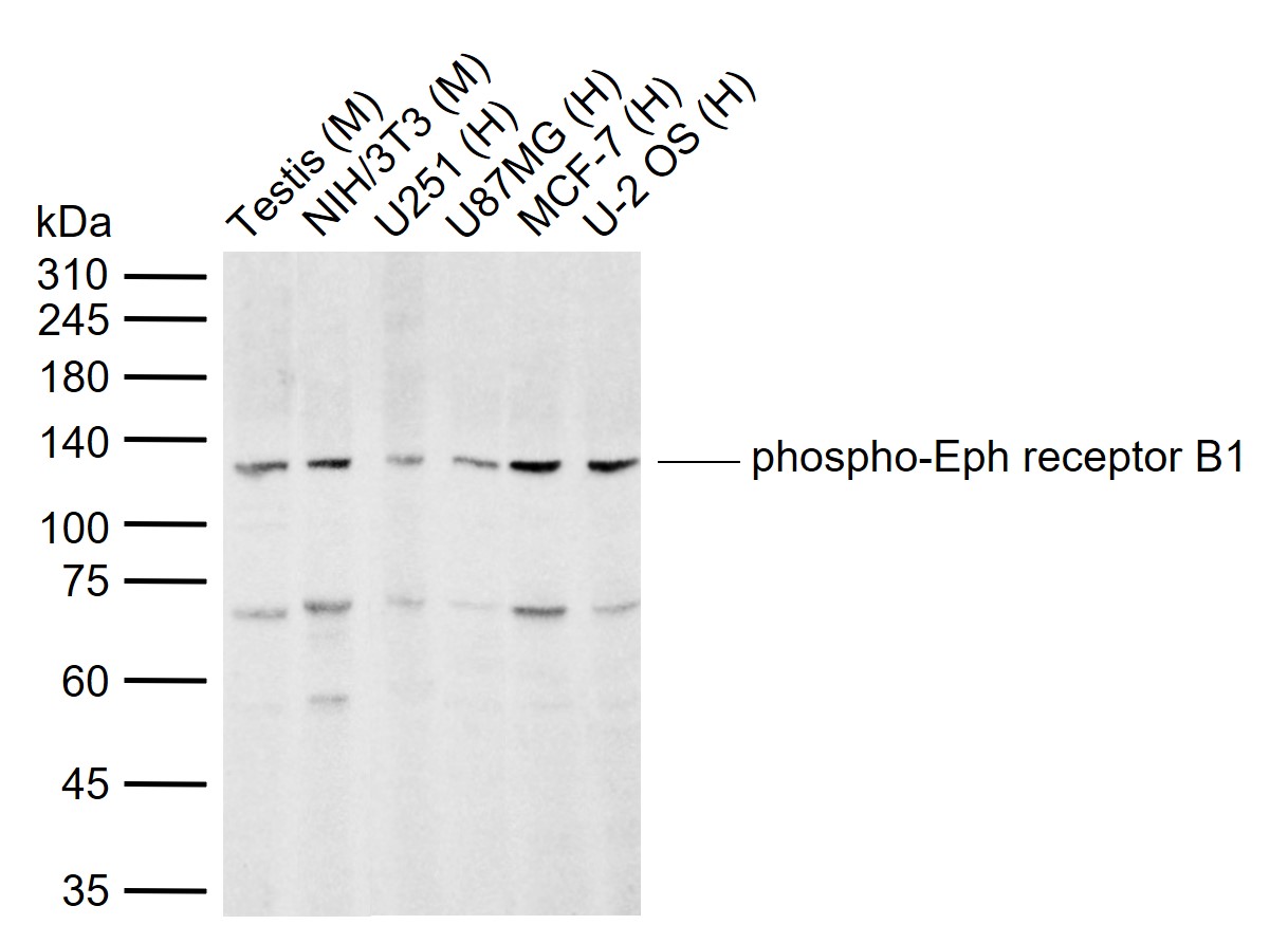 phospho-Eph receptor B1 (Tyr92