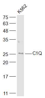 C1QA Rabbit pAb(bs-11336R)-50u