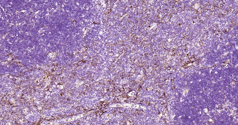 Cytokeratin 14 Recombinant Rab