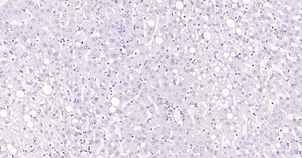 ACE2 Recombinant Rabbit mAb(bs