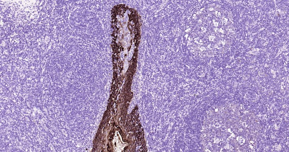Cytokeratin 14 Recombinant Rab