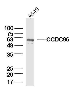 CCDC96 Rabbit pAb(bs-8144R)-50