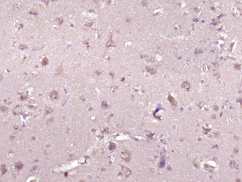 PKD2L1 Rabbit pAb(bs-23401R)-5